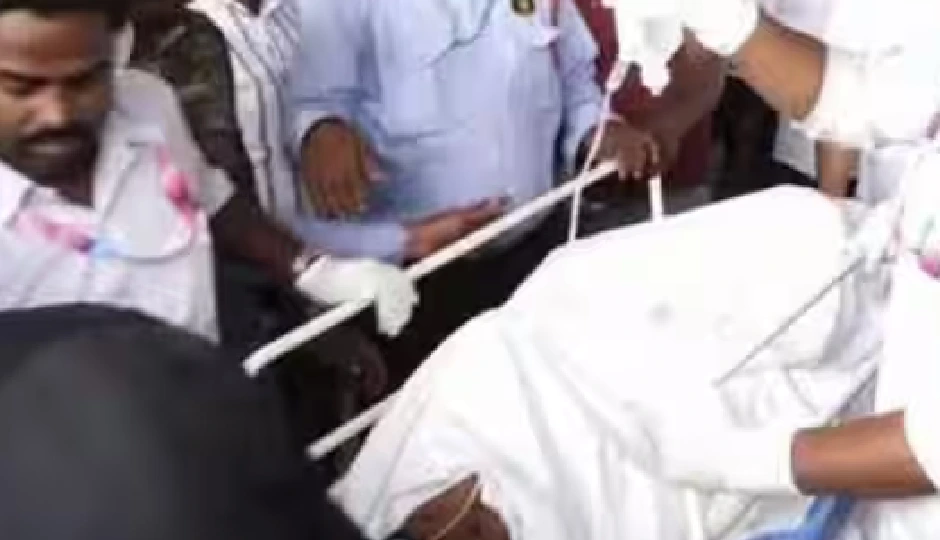 दिल्ली AIIMS में इलाज के दौरान नाबालिग की मौत, पुरी में अपहरण कर 3 लोगों ने लगाई थी आग