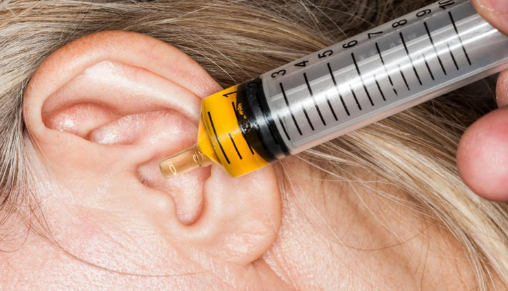 ear wax removal at home,natural remedies for ear wax,home treatments for ear wax,safe methods to remove ear wax,diy ear wax removal,ear wax removal without doctor,olive oil for ear wax,hydrogen peroxide for ear wax,ear wax softening techniques,gentle ear wax cleaning methods,effective home remedies for ear wax,natural ways to get rid of ear wax,preventing and managing ear wax buildup,ear hygiene tips for ear wax removal,quick and easy ear wax removal hacks