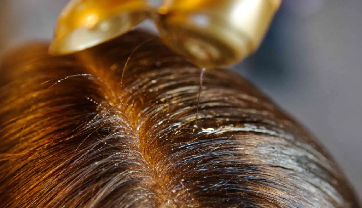 benefits of argan oil for hair,argan oil for hair care,argan oil hair benefits,why use argan oil for hair,nourishing hair with argan oil,how argan oil helps hair,argan oil hair treatments,argan oil for hair growth,argan oil for frizzy hair,moisturizing hair with argan oil,protecting hair with argan oil,argan oil for dry scalp,argan oil for hair shine,argan oil for damaged hair,vitamin e in argan oil for hair,argan oil scalp treatment,natural hair care with argan oil,argan oil for split ends,lightweight argan oil for hair,argan oil benefits for all hair types