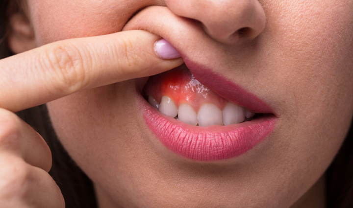 what is oil pulling how to do it and know about its benefits,Health,healthy living