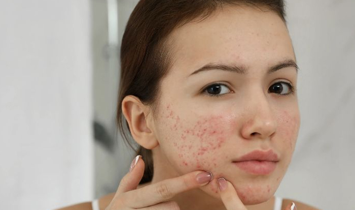 what is oil pulling how to do it and know about its benefits,Health,healthy living