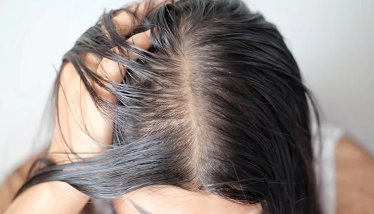 dry scalp,dry scalp treatment,remedies to treat dry scalp,home remedies to treat dry scalp,scalp care tips,scalp beauty,beauty,beauty tips
