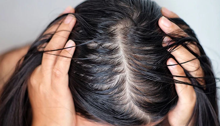 aloe vera,how to use aloe vera for hair growth,how do you use aloe vera for hair growth,benefits of aloe vera for hair,aloe vera oil for long and healthy hair,aloe vera oil for hair,aloe vera for hair mask,aloe vera for hair growth reviews,aloe vera for hair growth home remedies