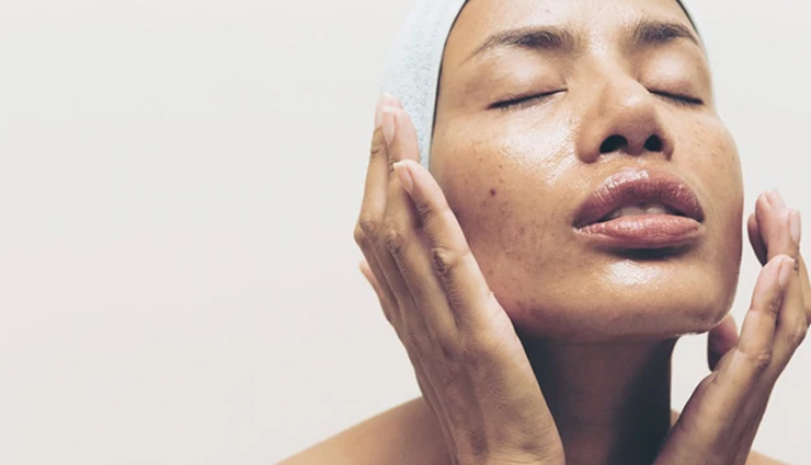 7 Foods You Should Eat To Prevent Oily Skin Naturally