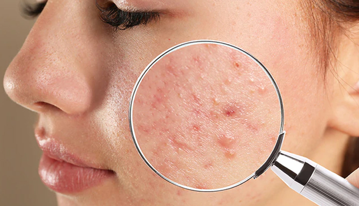 jojoba oil skin benefits,benefits of using jojoba oil on skin,natural skincare with jojoba oil,anti-aging benefits of jojoba oil,moisturizing properties of jojoba oil,jojoba oil skin hydration,jojoba oil skin elasticity,jojoba oil skin texture improvement,jojoba oil acne prevention,jojoba oil skin blemish reduction,jojoba oil skin inflammation reduction,jojoba oil skin scar reduction,jojoba oil sun damage protection,jojoba oil skin wound healing,jojoba oil skin ph balance restoration