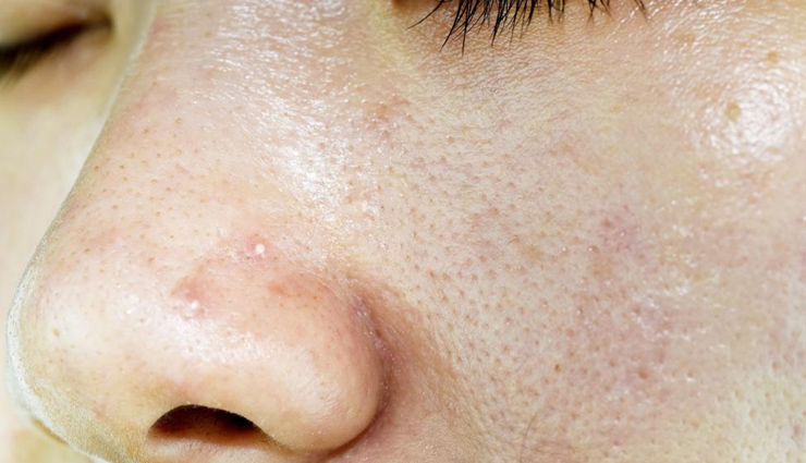 skin issues,skin treatment,food for healthy skin,skin care tips,beauty tips,beauty