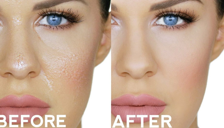 beauty tips,skin care tips,home remedies,oily skin,tips for oily skin