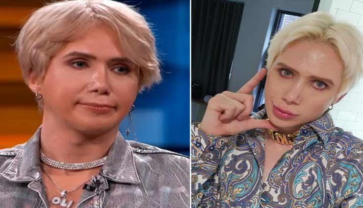 पॉप गायक जैसा दिखने के लिए शख्स ने खर्च कर डाले करोड़ों रुपये, करवा चुके हैं कई प्लास्टिक सर्जरी