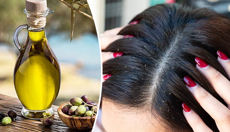 5 Ways To Use Olive Oil To Get Rid of Dandruff