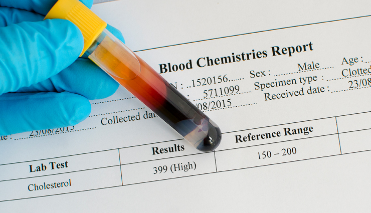 health benefits of olive oil,Olive Oil,Health tips,fitness tips