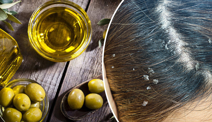 5 DIY Ways To Use Olive Oil To Get Rid of Dandruff
