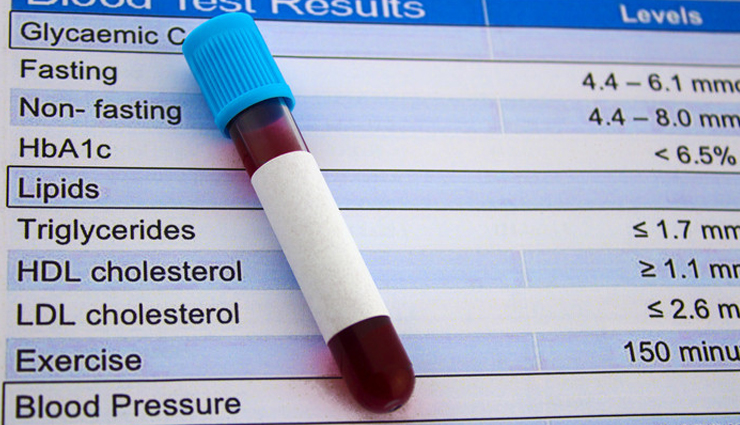 onion,health benefits of onion,Health tips,fitness tips