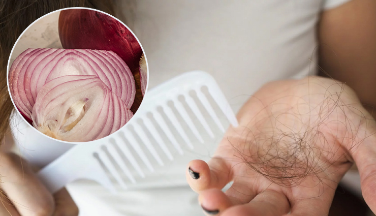 6 Different Ways To Use Onion Juice For Hair Care