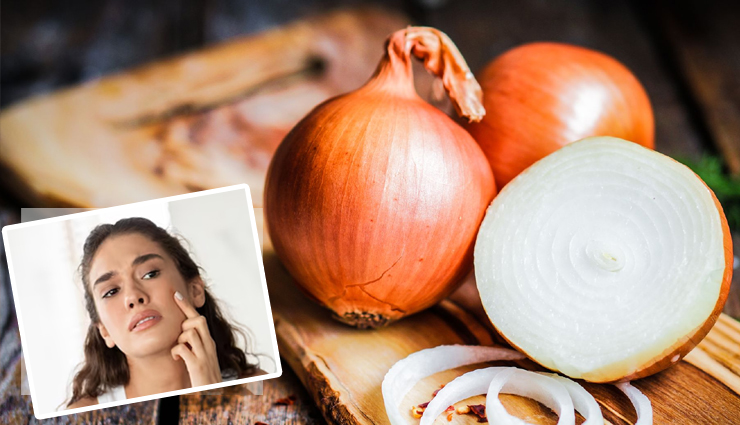 8 Benefits of Using Onions for Skin