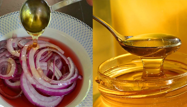 hair fall,hair fall treatment,hair fall home remedies,hair fall remedies,beauty,beauty tips