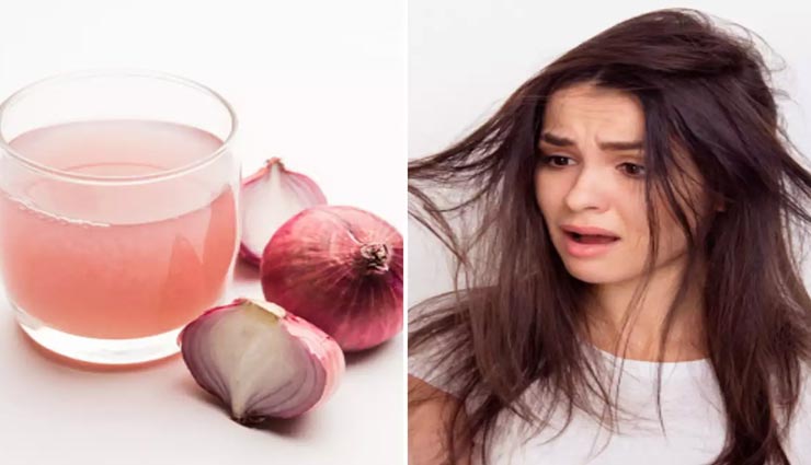 beauty tips,beauty tips in hindi,scalp remedies,home remedies