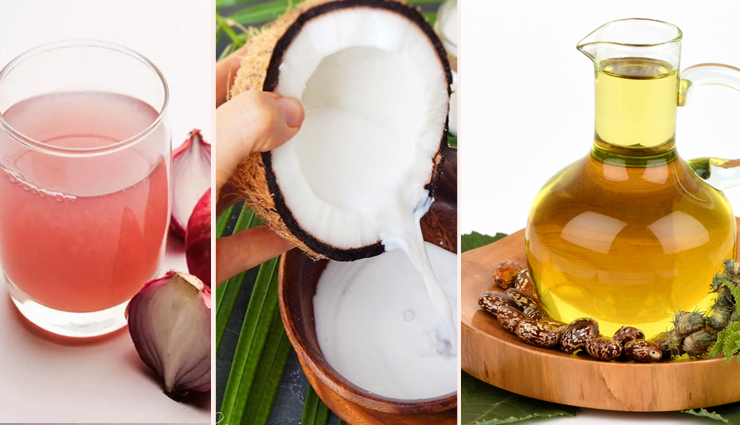 ways to use onion juice for hair growth,onion juice for hair,hair care tips,benefits of onion juice,onion for hair,beauty tips,beauty hacks