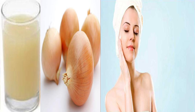 beauty tips,onion juice benefits,skin care tips,blackheads,beautiful face,simple beauty tps