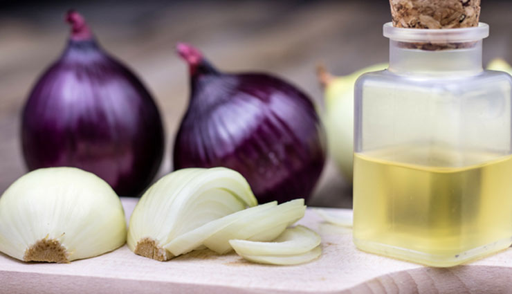 5 Ways To Use Onion Juice To Treat Hair Loss Quickly