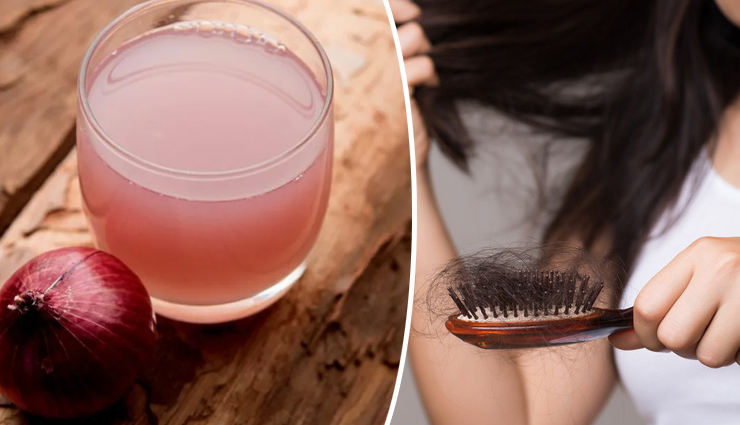 onion for skin and hair,diy onion beauty recipes,benefits of onion for acne,onion hair growth treatment,natural onion skincare,onion hair care tips,onion scalp benefits,homemade onion face masks,onion for anti-aging,onion dandruff remedy