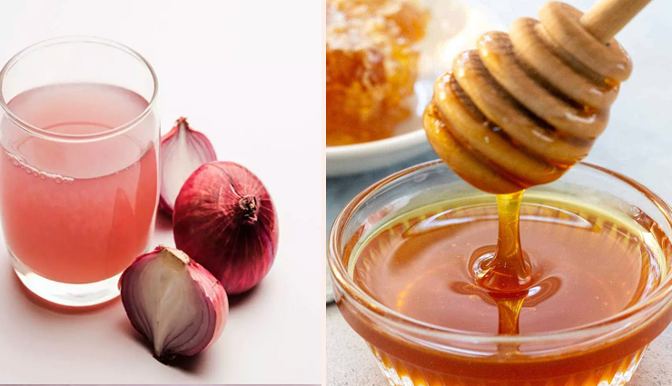 ways to use onion juice for hair growth,onion juice for hair,hair care tips,benefits of onion juice,onion for hair,beauty tips,beauty hacks
