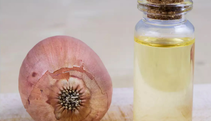 onion mask,diy onion mask,mask for hair,hair care tips,beauty tips,remedies for itchy scalp,remedies for dry scalp