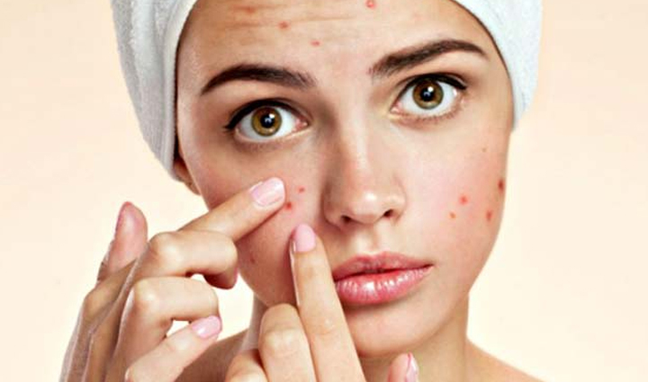 onion,which enhances the taste of food can improve the skin know how,beauty tips,beauty hacks