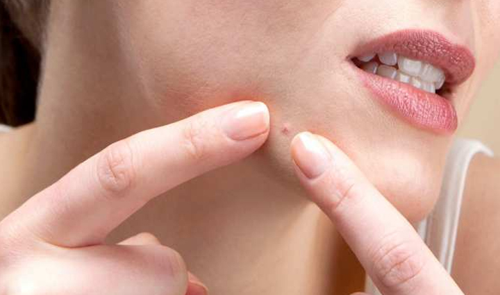 onion,which enhances the taste of food can improve the skin know how,beauty tips,beauty hacks