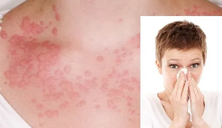 harmful effects of eating onions,eating onions in excess amount,side effects of onion,Health tips,fitness tips