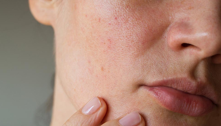 skin whitening,tomato for skin whitening,skin whitening tips,benefits of using tomato for skin,skin care,skin care tips,benefits of tomato for skin