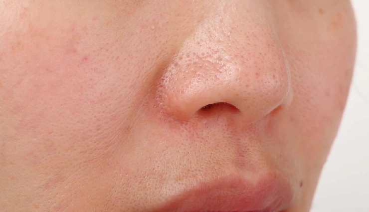 benefits of tomatoes for skin,tomatoes for body care,natural skincare remedies,antioxidant-rich foods,tomatoes for glowing skin,home remedies with tomato,tomato face pack,skincare with tomatoes,vitamin c for skin,natural beauty tips