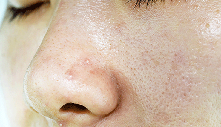 hidden benefits of retinaldehyde for skin,uncommon advantages of using retinaldehyde,lesser-known impacts of retinaldehyde on skin,discover the secret benefits of retinaldehyde,retinaldehyde underrated skin benefits,exploring the lesser-known perks of using retinaldehyde