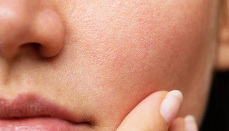 open pores remedies at home,natural ways to reduce skin pores,home treatments for enlarged pores,diy solutions for open pores on face,effective home remedies for skin pore reduction,reduce facial pores naturally at home,tips to minimize open pores naturally,home remedies for flawless skin texture,best natural remedies for open pores,how to shrink pores naturally at home