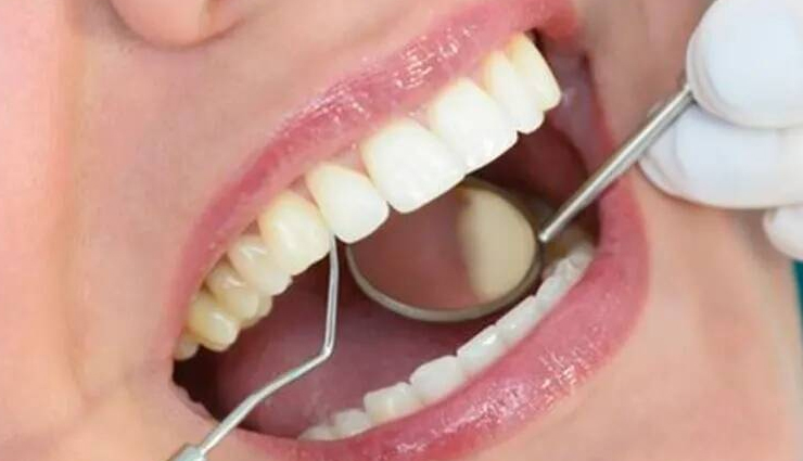 शरीर को स्वस्थ रखने के लिए जरूरी है दांतों का स्वस्थ रहना, डाइट में शामिल करें इन चीजों को, घरेलू नुस्खों से रखें सुरक्षित