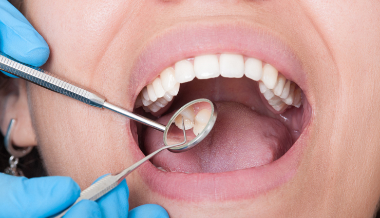 black spots on tongue,lingual melanosis,tongue discoloration,oral hygiene tips,tongue scraping benefits,hydration for oral health,healthy diet for tongue health,natural mouth rinses,oil pulling benefits,tobacco and oral health,probiotics for oral hygiene,tongue health remedies,tongue care tips,causes of black spots on tongue,oral health awareness