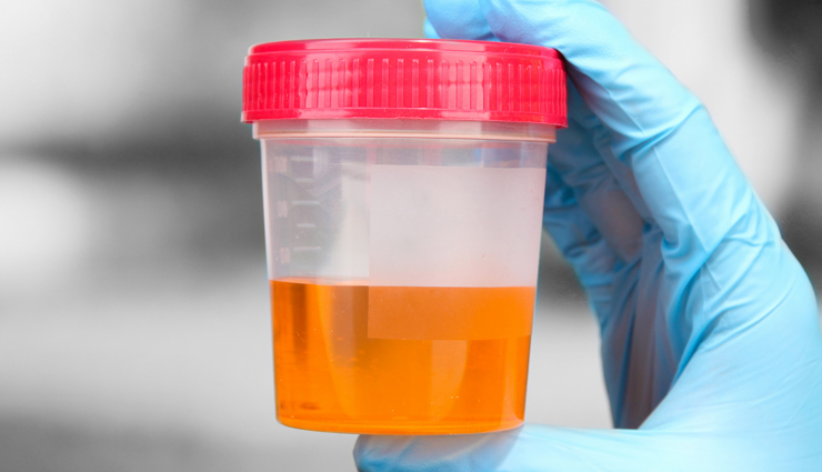 urine color,meaning of urine color,urine,Health,Health tips