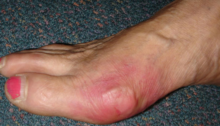 oranges,health benefits of oranges,Health tips,fitness tips