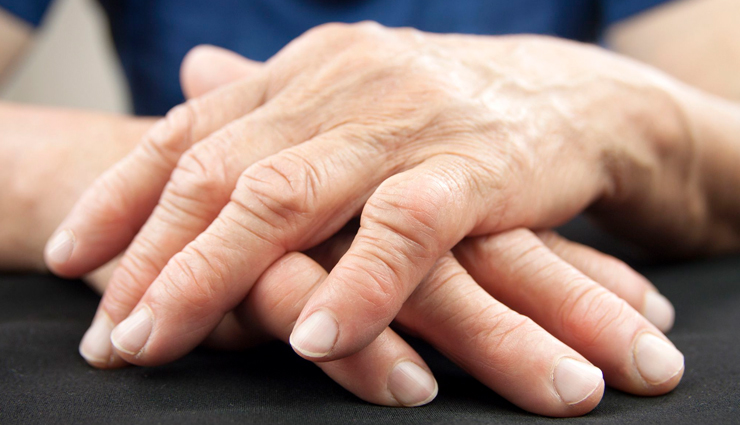 osteoarthritis,symptoms of osteoarthritis,Health tips,fitness tips