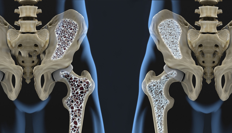 health benefits of barley,barley benefits,barley health benefits,barley,high blood pressure,cardiovascular health,prevent osteoporosis,prevent diabetes,lose weight,gall stones,risk of cancer,childhood asthma,bowel movement,skin elasticity,Health,Health tips