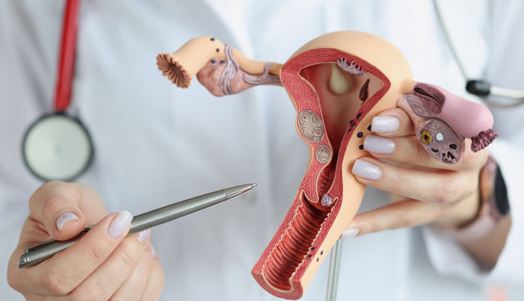 5 Yoga Poses To Treat Ovarian Cysts