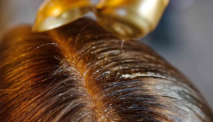 hair oiling mistakes,common hair oiling errors,how to oil hair correctly,benefits of hair oiling,hair care tips,dandruff and hair oil,overnight hair oiling,scalp health tips,prevent hair loss,natural hair masks,proper oil application,oiling for oily scalp
