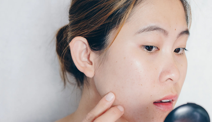 5 Natural Tricks To Get Rid of Acne Overnight