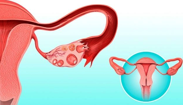 reasons you might be having pain in your ovaries,healthy living,Health tips