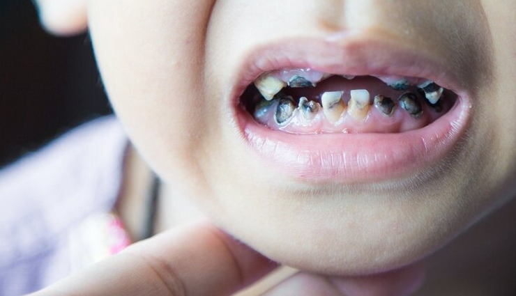 oyster mushrooms,health benefits of oyster mushrooms,Health tips,fitness tips