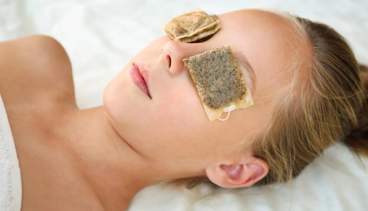 puffy eyes,puffy eyes cure,beauty,beauty tips