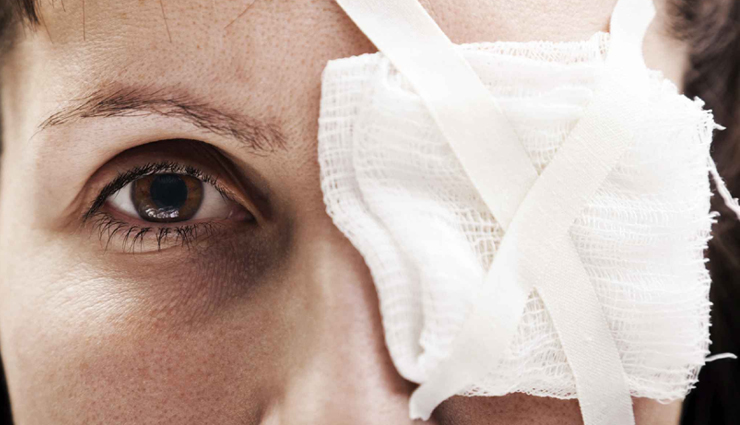 bells palsy,home remedies to treat bells palsy,bells palsy problem,bells palsy health problem,tips to get rid of bells palsy,Health,Health tips,healthy living