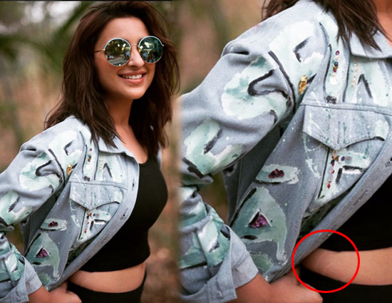 परिणीति चोपड़ा ने बिना झिझके सोशल मीडिया पर दिखाए  पेट के स्ट्रेच मार्क, आने लगे शादी के प्रपोजल!