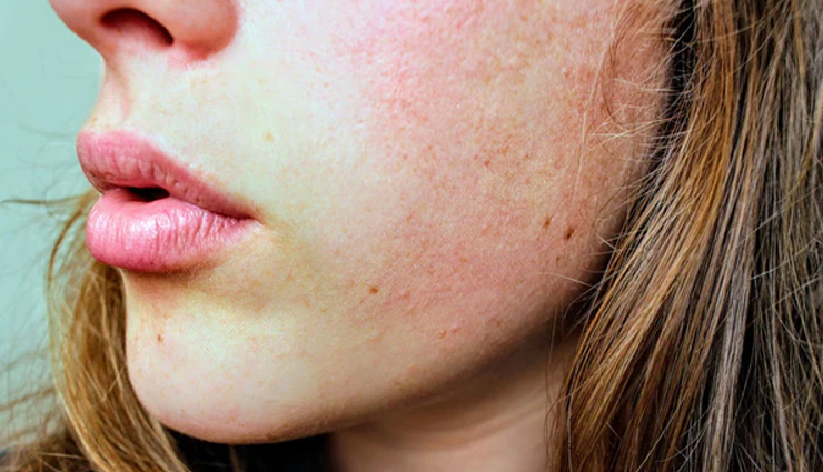 skin problems that indicate severe health conditions,beauty tips,beauty hacks