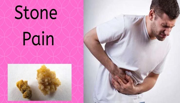 बिना ऑपरेशन के करें पथरी का इलाज, ये घरेलू उपचार करेंगे आपकी मदद 