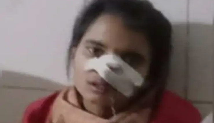 UP News: सीतापुर में पति ने काटी पत्नी की नाक, सिपाही के पद पर है तैनात